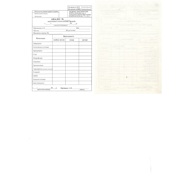Бланк Аналіз виділення із сечостатевих органів (ф.218/о), А6, 1+0, 1 арк.